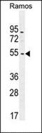 Integrin Subunit Alpha 5 antibody, orb221434, Biorbyt, Western Blot image 