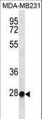 rTFEC antibody, LS-C156208, Lifespan Biosciences, Western Blot image 