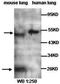 Achaete-Scute Family BHLH Transcription Factor 1 antibody, orb77209, Biorbyt, Western Blot image 