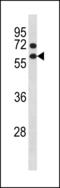 Cycb antibody, LS-C203887, Lifespan Biosciences, Western Blot image 