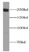 Piezo Type Mechanosensitive Ion Channel Component 1 antibody, abx236435, Abbexa, Western Blot image 