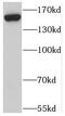 Secretion Associated Ras Related GTPase 1A antibody, FNab07606, FineTest, Western Blot image 