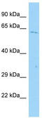 Acyl-CoA Synthetase Medium Chain Family Member 2A antibody, TA332273, Origene, Western Blot image 