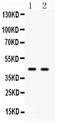 Cell Division Cycle 37 antibody, PA2139, Boster Biological Technology, Western Blot image 
