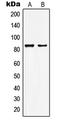 Lysine Acetyltransferase 7 antibody, LS-C353313, Lifespan Biosciences, Western Blot image 