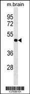 Protein Phosphatase 4 Regulatory Subunit 2 antibody, 59-916, ProSci, Western Blot image 