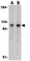 Toll Like Receptor 3 antibody, GTX20260, GeneTex, Western Blot image 