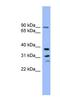 Phospholysine Phosphohistidine Inorganic Pyrophosphate Phosphatase antibody, NBP1-70600, Novus Biologicals, Western Blot image 