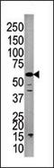 Protein Phosphatase 3 Catalytic Subunit Gamma antibody, 63-487, ProSci, Western Blot image 