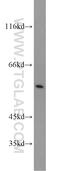 ADAMTS Like 2 antibody, 10320-1-AP, Proteintech Group, Western Blot image 