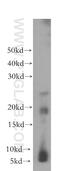 Crystallin Gamma C antibody, 17931-1-AP, Proteintech Group, Western Blot image 