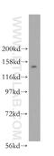 Nucleoporin 160 antibody, 16084-1-AP, Proteintech Group, Western Blot image 