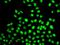 DNA Polymerase Delta 3, Accessory Subunit antibody, GTX32795, GeneTex, Immunofluorescence image 