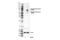 Phosphoinositide-3-Kinase Regulatory Subunit 1 antibody, 17366S, Cell Signaling Technology, Western Blot image 