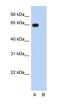 G3BP Stress Granule Assembly Factor 1 antibody, orb329936, Biorbyt, Western Blot image 