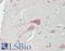 Mitogen-Activated Protein Kinase Kinase Kinase 13 antibody, LS-B13619, Lifespan Biosciences, Immunohistochemistry paraffin image 