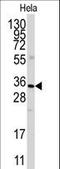 Annexin A3 antibody, LS-C97319, Lifespan Biosciences, Western Blot image 