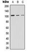 Protein Kinase D2 antibody, LS-C368476, Lifespan Biosciences, Western Blot image 