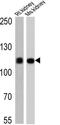 ATPase Na+/K+ Transporting Subunit Alpha 1 antibody, GTX22872, GeneTex, Western Blot image 