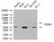 Transforming Growth Factor Beta Receptor 1 antibody, CSB-PA023451LA01HU, Cusabio, Western Blot image 