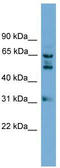 Cilia And Flagella Associated Protein 52 antibody, TA340385, Origene, Western Blot image 