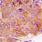 Glycogen Synthase Kinase 3 Alpha antibody, GTX32191, GeneTex, Immunohistochemistry paraffin image 