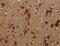 Lysine Methyltransferase 2B antibody, MBS2529407, MyBioSource, Immunohistochemistry paraffin image 