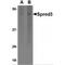 Sprouty Related EVH1 Domain Containing 3 antibody, MBS150128, MyBioSource, Western Blot image 