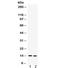 S100 Calcium Binding Protein A9 antibody, R31896, NSJ Bioreagents, Western Blot image 