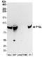 Glycogen Phosphorylase L antibody, NBP2-32246, Novus Biologicals, Western Blot image 