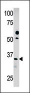 Pyridoxal Kinase antibody, 62-699, ProSci, Western Blot image 