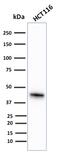 Keratin 18 antibody, GTX34644, GeneTex, Western Blot image 