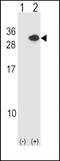 Regulator Of Calcineurin 1 antibody, LS-C162511, Lifespan Biosciences, Western Blot image 