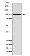 Interferon Gamma Receptor 1 antibody, M01716, Boster Biological Technology, Western Blot image 