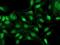 Alcohol Dehydrogenase 1B (Class I), Beta Polypeptide antibody, NBP2-00649, Novus Biologicals, Immunofluorescence image 