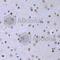 SOX2 antibody, A0561, ABclonal Technology, Immunohistochemistry paraffin image 