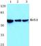 Potassium voltage-gated channel subfamily C member 1 antibody, A06871, Boster Biological Technology, Western Blot image 