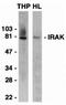 Interleukin 1 Receptor Associated Kinase 1 antibody, orb74307, Biorbyt, Western Blot image 