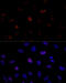 Proteasome Activator Subunit 3 antibody, 14-585, ProSci, Immunofluorescence image 