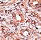 ABL Proto-Oncogene 1, Non-Receptor Tyrosine Kinase antibody, LS-C97399, Lifespan Biosciences, Immunohistochemistry paraffin image 