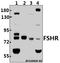 Follicle Stimulating Hormone Receptor antibody, A00897-2, Boster Biological Technology, Western Blot image 