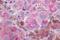 G Protein-Coupled Receptor 161 antibody, NLS331, Novus Biologicals, Immunohistochemistry paraffin image 