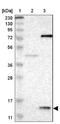 Prefoldin Subunit 1 antibody, NBP1-87294, Novus Biologicals, Western Blot image 
