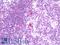 Protein Kinase C Theta antibody, LS-B11309, Lifespan Biosciences, Immunohistochemistry paraffin image 