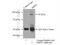 Hexose-6-Phosphate Dehydrogenase/Glucose 1-Dehydrogenase antibody, 15255-1-AP, Proteintech Group, Immunoprecipitation image 