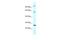 Transmembrane Protein 222 antibody, A17415, Boster Biological Technology, Western Blot image 