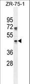 Zinc Finger Protein 578 antibody, LS-C160909, Lifespan Biosciences, Western Blot image 