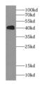 SH3 Domain Containing GRB2 Like, Endophilin B1 antibody, FNab00894, FineTest, Western Blot image 