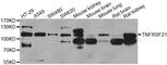 TNF Receptor Superfamily Member 21 antibody, A7365, ABclonal Technology, Western Blot image 