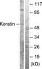 Keratin 8 antibody, LS-B12513, Lifespan Biosciences, Western Blot image 